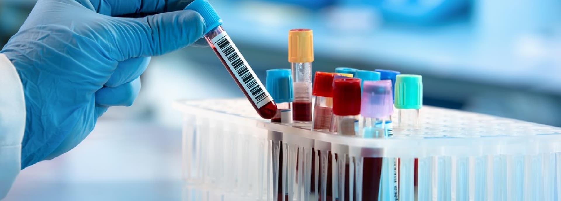 test tube vial in a rack